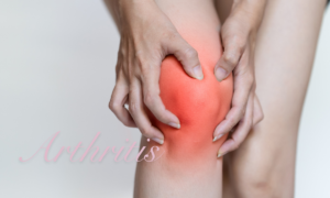 What Not To Do When You Are Diagnosed With Arthritis