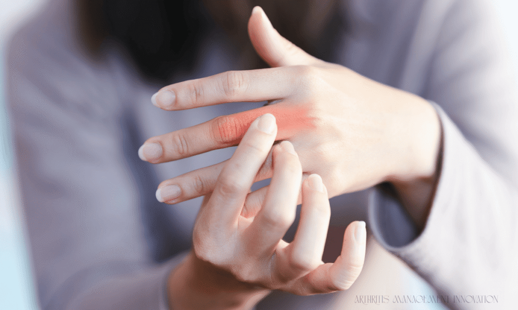 close-up of hand affected by rheumatoid arthritis inflammation as part of arthritis management innovation
